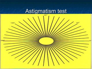Astigmatism testAstigmatism test
 