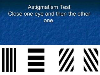 Astigmatism TestAstigmatism Test
Close one eye and then the otherClose one eye and then the other
oneone
 