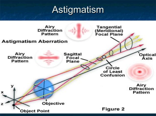 Astigmatism - Common Eye Condition | PPT