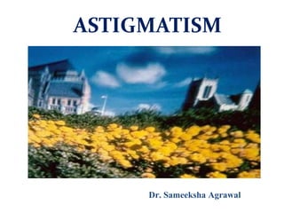 ASTIGMATISM
Dr. Sameeksha Agrawal
 