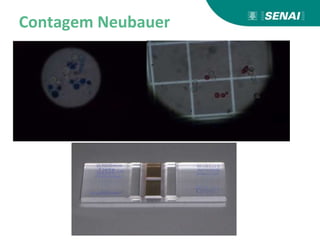 Contagem Neubauer
 