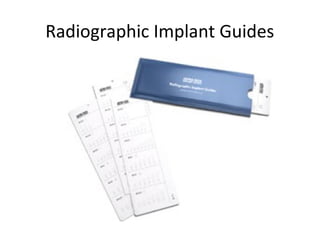 Radiographic Implant Guides
 