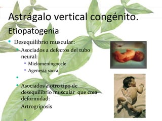 Astrágalo vertical congénito. Etiopatogenia   Desequilibrio muscular:  Asociados a defectos del tubo neural:  Mielomeningocele  Agenesia sacra  Asociados a otro tipo de desequilibrio muscular  que crea deformidad:  Artrogriposis  