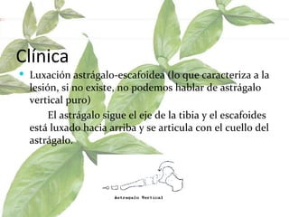 Clínica Luxación astrágalo-escafoidea (lo que caracteriza a la lesión, si no existe, no podemos hablar de astrágalo vertical puro)  El astrágalo sigue el eje de la tibia y el escafoides está luxado hacia arriba y se articula con el cuello del astrágalo.  