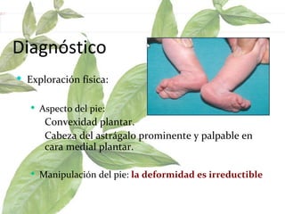 Diagnóstico Exploración física:  Aspecto del pie:  Convexidad plantar.  Cabeza del astrágalo prominente y palpable en  cara medial plantar.  Manipulación del pie:  la deformidad es irreductible  