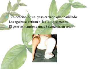 8.  Colocación de un  yeso cerrado almohadillado  Las agujas se retiran a  las  4 – 6 semanas  El yeso se mantiene unas 8 semanas en total. 