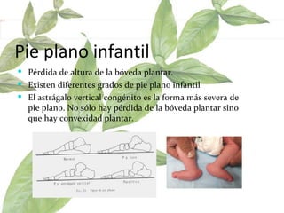 Pie plano infantil Pérdida de altura de la bóveda plantar.  Existen diferentes grados de pie plano infantil  El astrágalo vertical congénito es la forma más severa de pie plano. No sólo hay pérdida de la bóveda plantar sino que hay convexidad plantar.  