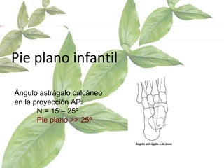 Pie plano infantil Ángulo astrágalo calcáneo en la proyección AP:  N = 15 – 25º  Pie plano >> 25º 