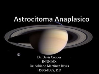 Astrocitoma Anaplasico Dr. Davis Cooper INNN.MX Dr. Adriano Martínez Reyes HSBG-IDSS, R.D 