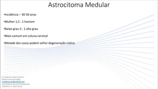 Astrocitoma Medular
•Incidência – 30-50 anos
•Mulher 1,5 : 1 homem
•Baixo-grau 3 : 1 alto grau
•Mais comum em coluna cervical
•Metade dos casos podem sofrer degeneração cistica
 