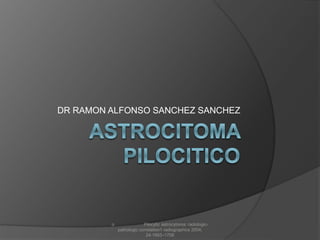 DR RAMON ALFONSO SANCHEZ SANCHEZ
o Pilocytic astrocytoma: radiologic-
pathologic correlation1 radiographics 2004;
24:1693–1708
 