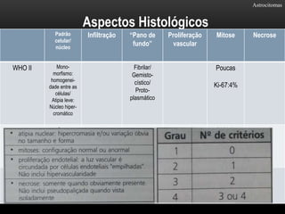Astrocitomas
Aspectos Histológicos
Padrão
celular/
núcleo
Infiltração “Pano de
fundo”
Proliferação
vascular
Mitose Necrose
WHO II Mono-
morfismo:
homogenei-
dade entre as
células/
Atipia leve:
Núcleo hiper-
cromático
Fibrilar/
Gemisto-
cístico/
Proto-
plasmático
Poucas
Ki-67:4%
WHO III
Astrocitoma
Anaplásico
Certa
variabilidade
entre as
células/
Atipia
significante
Menos
espaço
intercelular.
Atividade
mitótica
significante
WHO IV
Glioblastoma
Pleomorfis-mo:
pequenas até
grandes e
bizarros.
Pouco Importante –
índices de
proliferação
(Ki-67)
elevado.
 