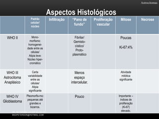 Astrocitomas
Aspectos Histológicos
Padrão
celular/
núcleo
Infiltração “Pano de
fundo”
Proliferação
vascular
Mitose Necrose
WHO II Mono-
morfismo:
homogenei-
dade entre as
células/
Atipia leve:
Núcleo hiper-
cromático
Fibrilar/
Gemisto-
cístico/
Proto-
plasmático
Poucas
Ki-67:4%
WHO III
Astrocitoma
Anaplásico
Certa
variabilidade
entre as
células/
Atipia
significante
Menos
espaço
intercelular.
Atividade
mitótica
significante
WHO IV
Glioblastoma
Pleomorfis-mo:
pequenas até
grandes e
bizarros.
Pouco Importante –
índices de
proliferação
(Ki-67)
elevado.DR. PETERSON XAVIER DA SILVA
MEDPETERSON@HOTMAIL.COM
 