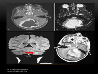 DR. PETERSON XAVIER DA SILVA
MEDPETERSON@HOTMAIL.COM
 
