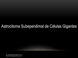 DR. PETERSON XAVIER DA SILVA
MEDPETERSON@HOTMAIL.COM
Astrocitoma Subependimal de Células Gigantes
 