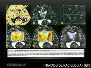 DR. PETERSON XAVIER DA SILVA
MEDPETERSON@HOTMAIL.COM TRATADO DE RADIOLOGIA - SBR
 