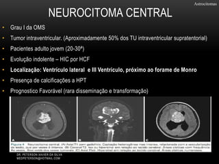 • Grau I da OMS
• Tumor intraventricular. (Aproximadamente 50% dos TU intraventricular supratentorial)
• Pacientes adulto jovem (20-30ª)
• Evolução indolente – HIC por HCF
• Localização: Ventrículo lateral e III Ventriculo, próximo ao forame de Monro
• Presença de calcificações a HPT
• Prognostico Favorável (rara disseminação e transformação)
Astrocitomas
NEUROCITOMA CENTRAL
DR. PETERSON XAVIER DA SILVA
MEDPETERSON@HOTMAIL.COM
 