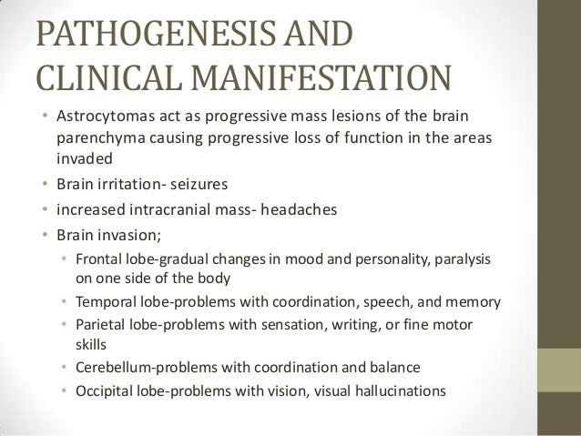 astrocytoma