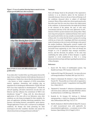 Figure 1. X-ray of a patient showing improvement in terms
ofbonegrowthdifferenceaftertreatment.
Role of Niche in stem cells differentiation and
proliferation
X-ray taken after 3 months follow up of the patient showed the
signs of new cartilage formation which indicates the process of
chodrogenesis. Studies have shown that the microenvironment
- also known as 'niche' comprised of ECM (extracellular
matrix), regulators, chemokines and cytokines play an
importantrole in chondrogenicdifferentiation.TGFβs, IGF and
[26]
FGF's have been implicated in chondrogenesis . Beside the
cell-cell signaling, cell-matrix interactions can also alter cell
behavior and thus influence the commitment of MSC's into
[25,26]
chondrocyte lineage . Along with the above-discussed
applications of the stem cells at our laboratory, some other
conditions are also being investigated for their suitability for
stem cell application including ankolysing spondylitis, bone
fractures, non healing fractures, osteoarthritis, sports injuries.
Though application of stem cells is well proven in orthopedic
conditions, the therapy also looks promising for other
neurological and other metabolic disorders and clinical for
[27]
whichclinicaltrialsarebeingperformedworldwide .
Summary
Stem cell therapy based on the principle of the regenerative
medicine is as an attractive option for the treatment of
intractable diseases. However, the use of stem cell therapy in all
the conditions discussed above is subject of individual
treatment. Many of these studies have shown quick good results
but at the same time few cases have shown slow improvement
in the conditions.As discussed earlier, this might also be linked
to the selection of the patient, the type of cells used,
concentration and dose of the cells used, application of cells ,
duration of follow up and evaluation tools among others. Many
more long-term prospective randomized human trials need to
have good results before one may actually recommend the use
of these cells. It is certain that the future is going to be exciting
with the use of stem cells. A paradigm shift from conventional
mode of treatments to the novel stem cells therapy is the need of
the modern healthcare. High-quality research coupled with
practical applications in the cellular medicine has set a stage for
successful tissue engineering in vitro. Stem cell therapy has
brought in a lot of optimistic hope amongst researchers,
doctors, and but obviously for patients. At the same time
establishing the safety profile of these therapies is equally
important to avoid complications as there is a strong
demarcation between hype and hope regarding the potential use
ofthesetherapies.
References
1. Kaiser LR. The future of multihospital systems. Top
HealthCareFinanc1992.Summer;18(4):32-45.
2. Anderson DJ, Gage FH,Weissman IL. Can stem cells cross
celllineageboundaries?NatMed.2001Apr;7(4):393-5.
3. Ehnert S, Glanemann M, Schmitt A, Vogt S, Shanny N,
Nussler NC. The possible use of stem cells in regenerative
medicine: dream or reality?. LangenbecksArch Surg 2009
Nov;394(6):985-97.
4. Takahashi K, Yamanaka S. Induction of pluripotent stem
cells from mouse embryonic and adult fibroblast cultures
bydefinedfactors.Cell2006Aug;126(4):663-76.
5. Rodolfa K, Di Giorgio FP, Sullivan S. Defined
reprogramming: a vehicle for changing the differentiated
state.Differentiation2007Sep;75(7):577-9.
6. Mafi R, Hindocha S, Mafi P, Griffin M, Khan WS. Sources
of adult mesenchymal stem cells applicable for
musculoskeletal applications—a systematic review of the
literature.OpenOrthopJ2011(5Suppl2):242-8.
44
 