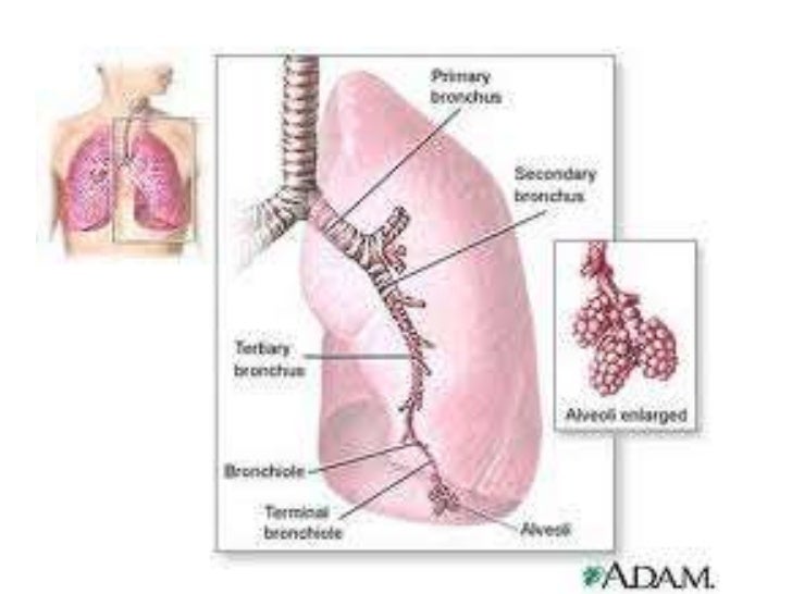 Askep Bronchopneumonia Pdf Askep Bronchopneumonia Pdf