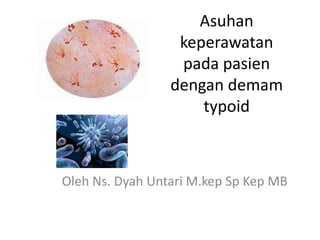 Asuhan
keperawatan
pada pasien
dengan demam
typoid
Oleh Ns. Dyah Untari M.kep Sp Kep MB
 