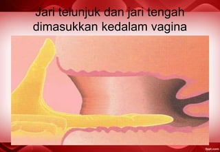 Jari telunjuk dan jari tengah
dimasukkan kedalam vagina
 