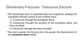 A Summary Of Fractures Of Acetabulum Judet And Letournel PART 1 PPT a-summary-of-fractures-of-acetabulum-judet-and-letournel-part-1-ppt