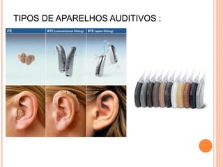 A surdez e suas implicaçoes