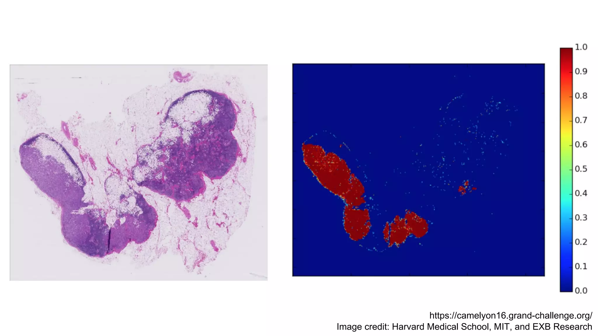 https://camelyon16.grand-challenge.org/
Image credit: Harvard Medical School, MIT, and EXB Research
 