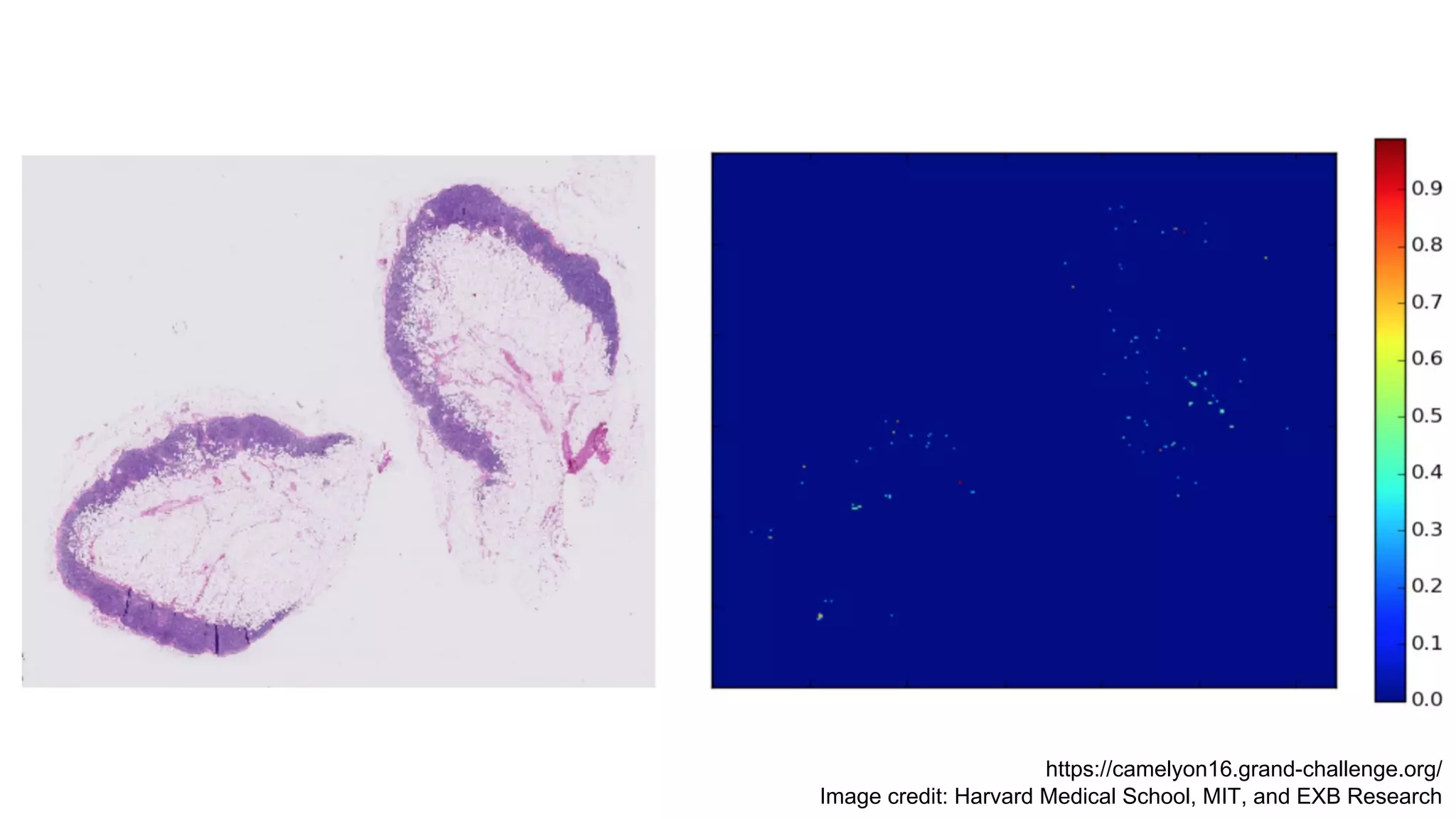 https://camelyon16.grand-challenge.org/
Image credit: Harvard Medical School, MIT, and EXB Research
 