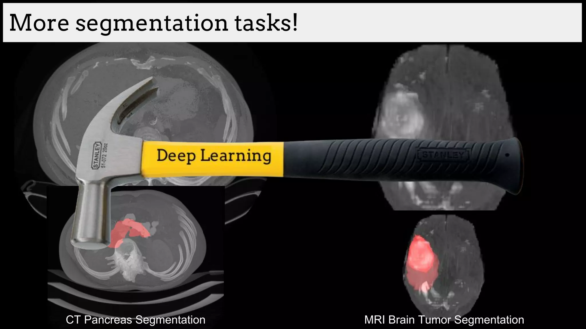 More segmentation tasks!
CT Pancreas Segmentation MRI Brain Tumor Segmentation
 