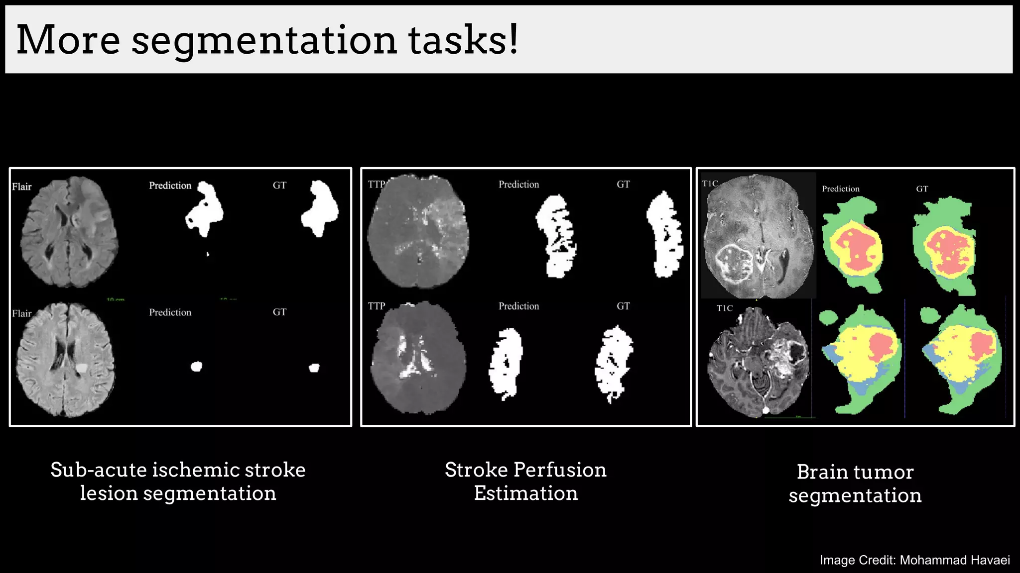 Sub-acute ischemic stroke
lesion segmentation
Stroke Perfusion
Estimation
Brain tumor
segmentation
More segmentation tasks!
Image Credit: Mohammad Havaei
 