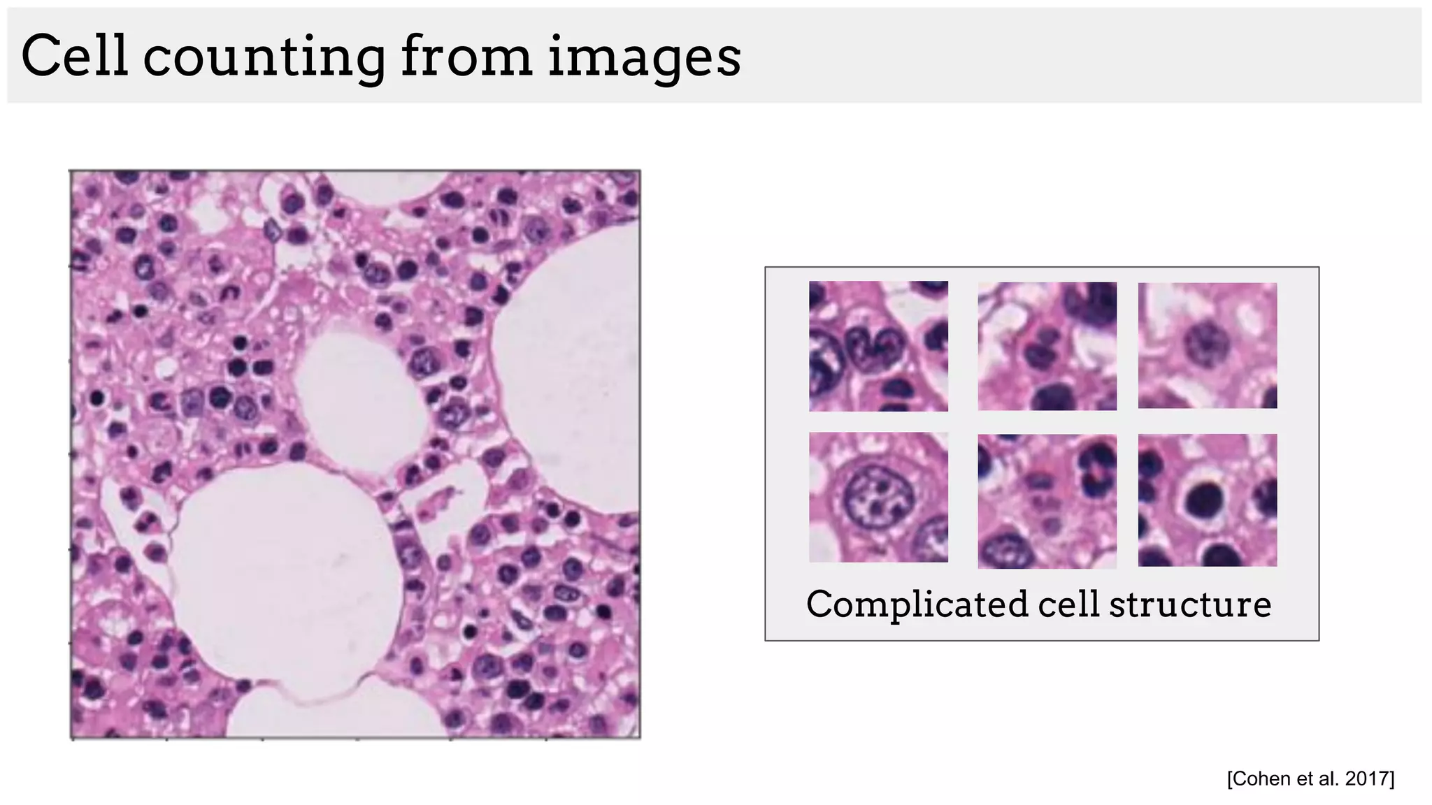[Cohen et al. 2017]
Complicated cell structure
Cell counting from images
 