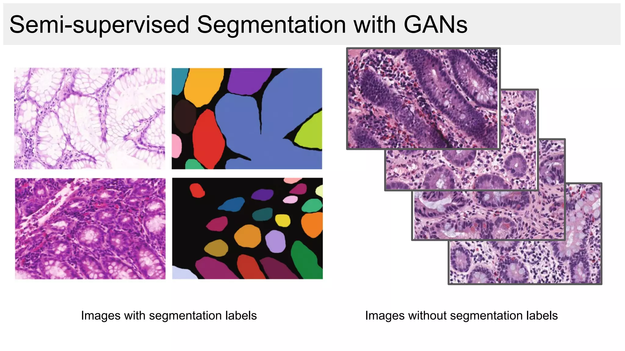 Semi-supervised Segmentation with GANs
Images with segmentation labels Images without segmentation labels
 