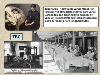 Tuberkulos - 1800-talets värsta farsot När
farsoten vid 1800-talets mitt var som värst i
Europa tog den omkring fyra miljoner liv
varje år. I sverige1930-talet dog årligen nära
8.000 personer pr år i lungtuberkulos
TBC
 