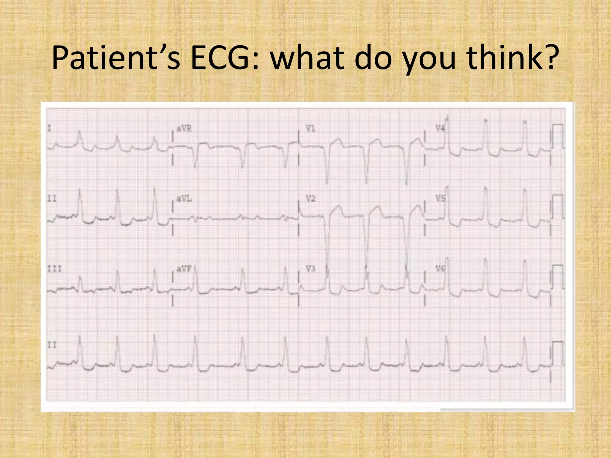 Patient’s ECG: what do you think?
 