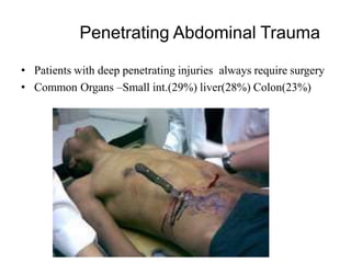 Penetrating Abdominal Trauma
• Patients with deep penetrating injuries always require surgery
• Common Organs –Small int.(29%) liver(28%) Colon(23%)
 