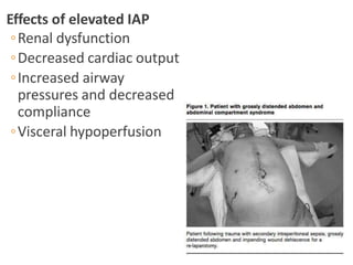 Effects of elevated IAP
◦Renal dysfunction
◦Decreased cardiac output
◦Increased airway
pressures and decreased
compliance
◦Visceral hypoperfusion
 