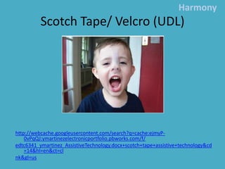 Scotch Tape/ Velcro (UDL)Harmonyhttp://webcache.googleusercontent.com/search?q=cache:ejmyP-0vPqQJ:ymartinezelectronicportfolio.pbworks.com/f/edtc6341_ymartinez_AssistiveTechnology.docx+scotch+tape+assistive+technology&cd=14&hl=en&ct=clnk&gl=us