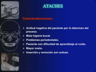 Resilentes: Tienen la habilidad de moverse libremente en todos los planos sin ligarlos al torque del diente.Mini Dalbo(Omcast , Stern Gingival, McCollum
