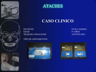 Periodontalmente favorable.