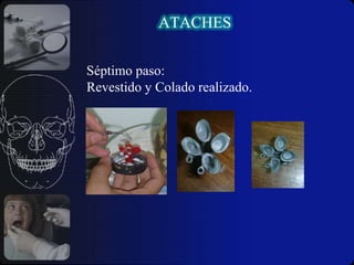 Paciente con dificultad de aprendizaje al cuido.