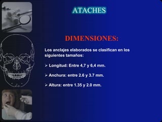ATACHESDIMENSIONES:Los anclajes elaborados se clasifican en los siguientes tamaños: Longitud: Entre 4,7 y 6,4 mm.