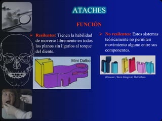 ATACHESRETENCIÓNResistencia activa contra la dislocaciónLa retención en los elementos de anclaje se consigue por diversos mecanismos:FRICCIÓN: es la resistencia en relación al movimiento de dos o más superficies con paredes paralelas con ajuste exacto.Anclaje Binat 