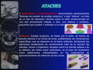 ATACHESMAGNÉTICA: es la resistencia al movimiento causado por un cuerpo magnético que atrae ciertos materiales a su alrededor por la ventaja de producir fuerzas de atracción por el movimiento atómico de sus electrones y la alineación de sus átomos, éstos pueden ser intrarradiculares o supra radiculares.Se clasifican en dos grandes grupos:Imanes de campo magnético abierto: se programa más allá del imán y se pierde a través de los tejidos blandos que lo rodean.Imán Dyna. Imanes de campo magnético cerrado: su influencia queda circunscrita dentro del anclajeImán Cemag.