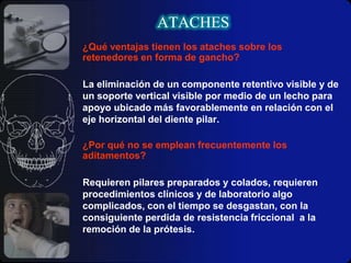 ATACHESLOCALIZACIÓNDentro de esta categoría los aditamentos son clasificados de acuerdo a la relación que guardan éstos con el diente y pueden ser:Intracoronario: En éstos el anclaje se incorpora al diente.