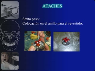 Problemas periodontales.