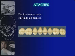  La excesiva reducción coronaria.