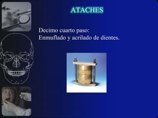  Necesidad de que el pilar debe ser de longitud 