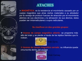SU LOCALIZACIÓNATACHESFABRICACIÓNPRECISIÓNSEMI-PRECISIÓNSon prefabricados, sus componentes son maquinados en aleaciones especiales, una gran mayoría de ellas son de platino, paladio, oro, plata, cobre e iridio éstas son más duras y resistentes al desgaste y a las elevadas temperaturas asociadas con el colado de aleaciones de metal-porcelana.Son elaborados en laboratorio, frecuentemente son denominados “colas de milano” debido a la forma de sus componentes engranados. Se pueden fabricar incorporando componentes de plásticos, nylon, cera o encerados a mano, presentando una menor tolerancia a la precisión, siendo aptos para ser colados con metal precioso. 